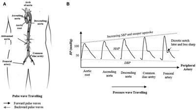 Estimation of central blood pressure waveform from femoral blood pressure waveform by blind sources separation